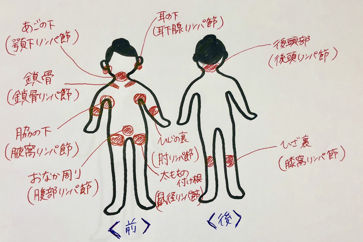 リンパ節の腫れはどうやって調べるのですか?