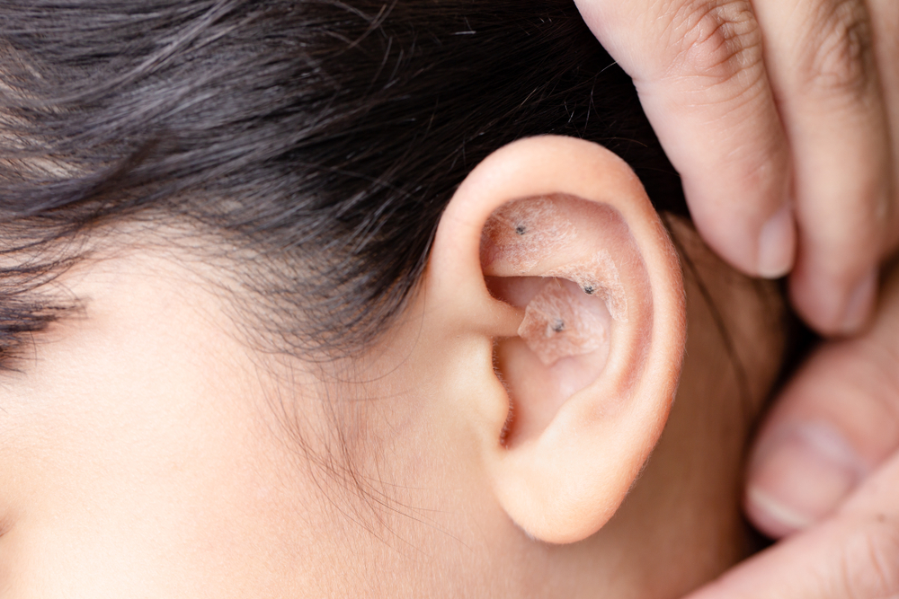 耳の反射区とは 耳ツボはダイエットにも効果的 位置など図を合わせて解説 Melby メルビー